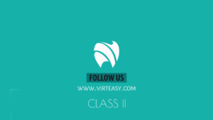 Class_II_Treatment_Virteasy_Dental