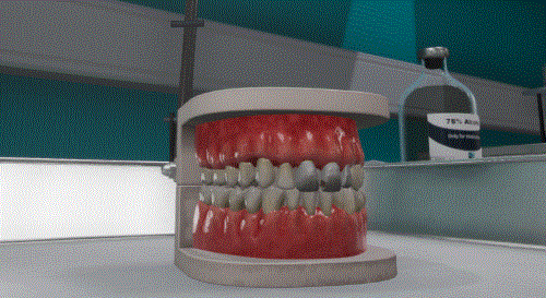 Animations Virteasy Dental