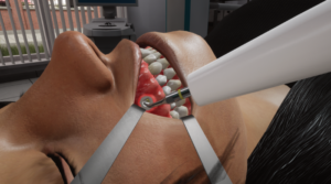 Micro-Endodontie