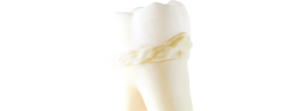 Acadental